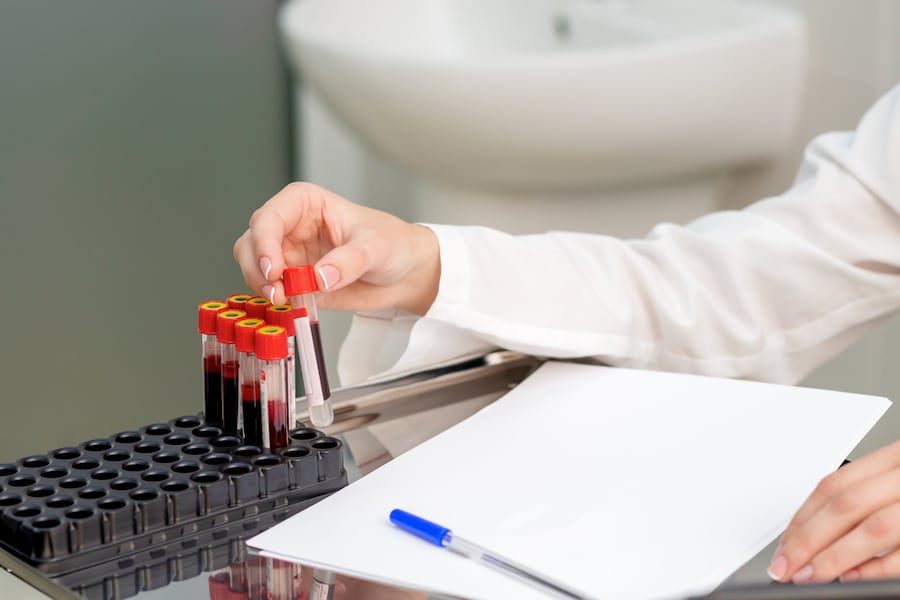 Is Covid Testing Covered by Health Insurance